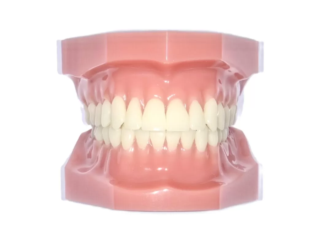 裏側矯正(表から)|東京・足立区の矯正歯科ならさくら参道歯科・矯正歯科