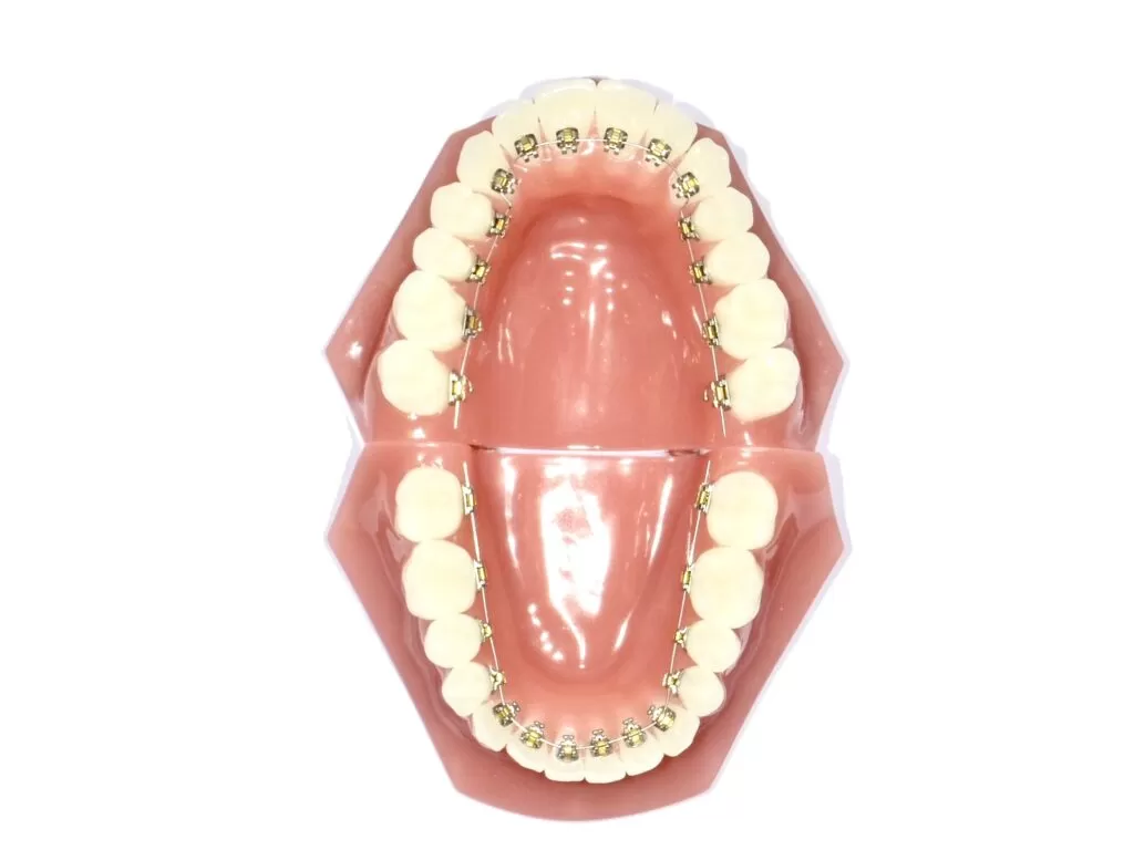 舌側矯正|東京・足立区の矯正歯科ならさくら参道歯科・矯正歯科