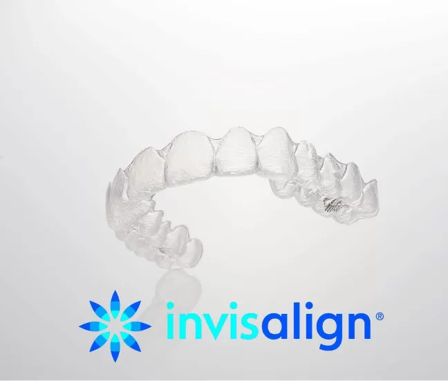 インビザライン矯正の特長